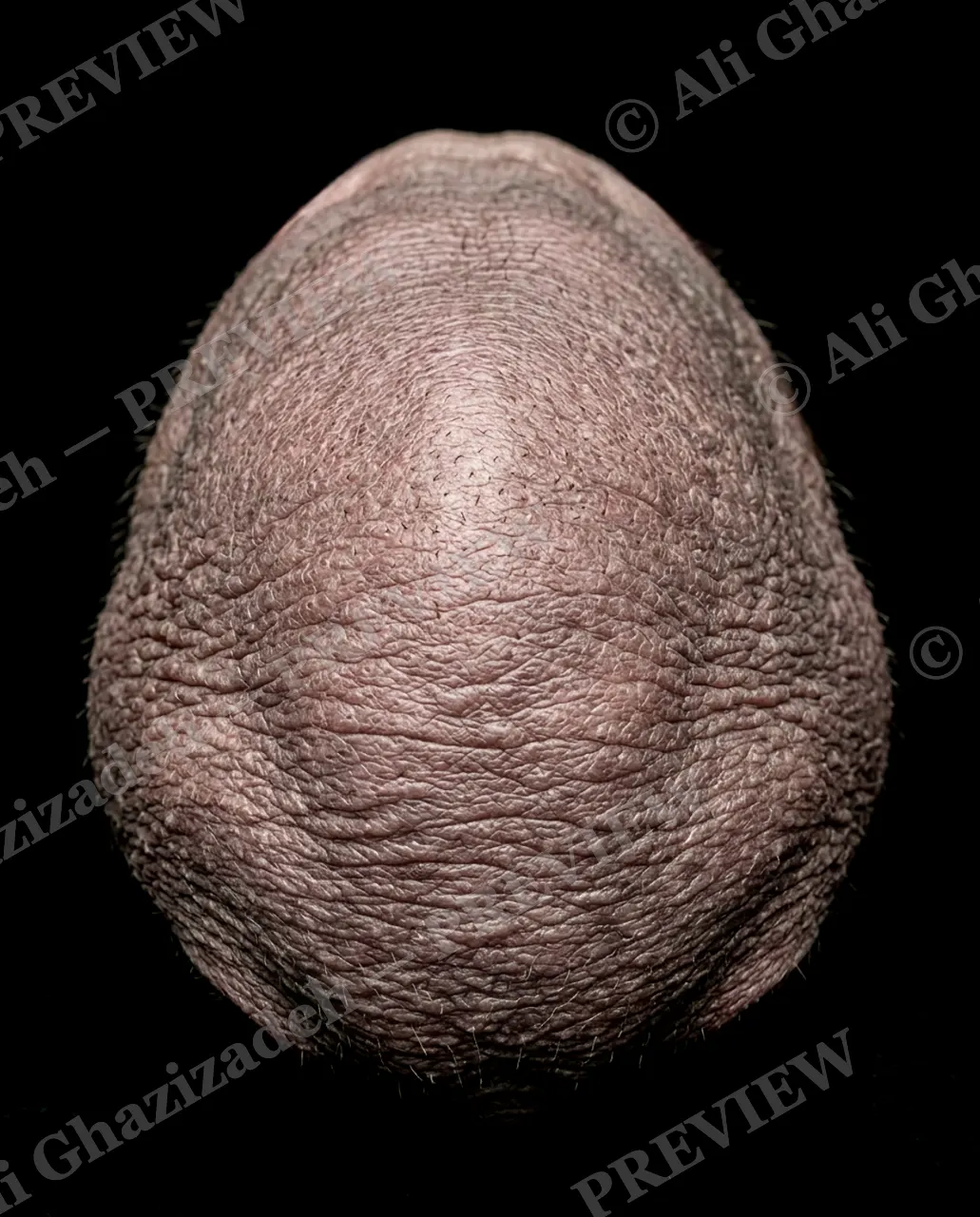 Naked Truth — Bald as an Egg — Naked mole-rat artwork by Ali Ghazizadeh
