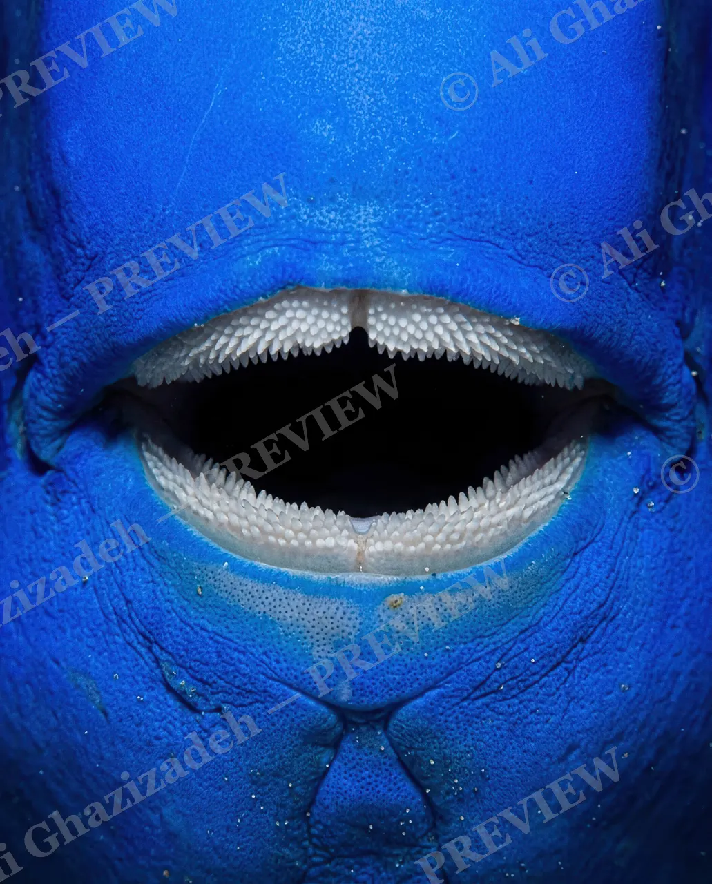 Say Ahh — First Patient — Parrotfish artwork by Ali Ghazizadeh